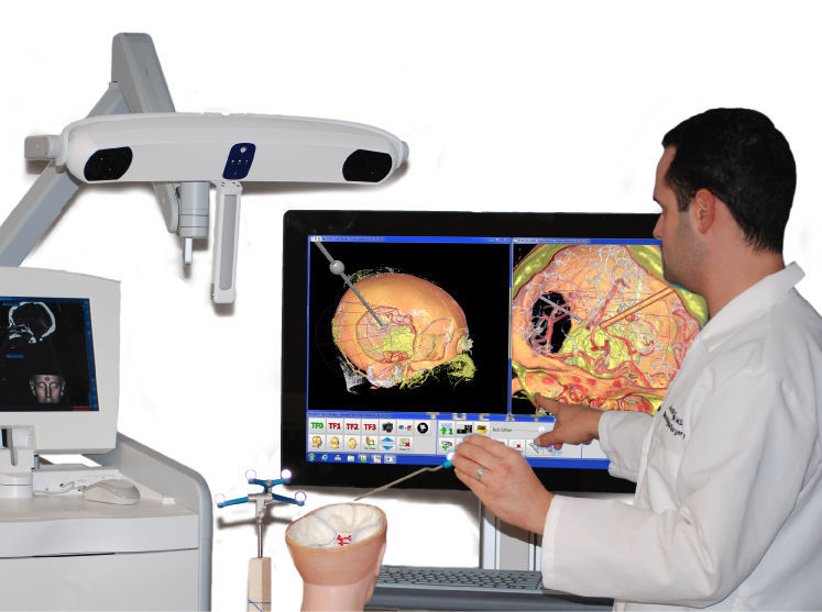 Surgical Navigation Systems Market 2019 Global Industry Analysis, Emerging Technology, Sales Revenue and Comprehensive Research Study Till 2023