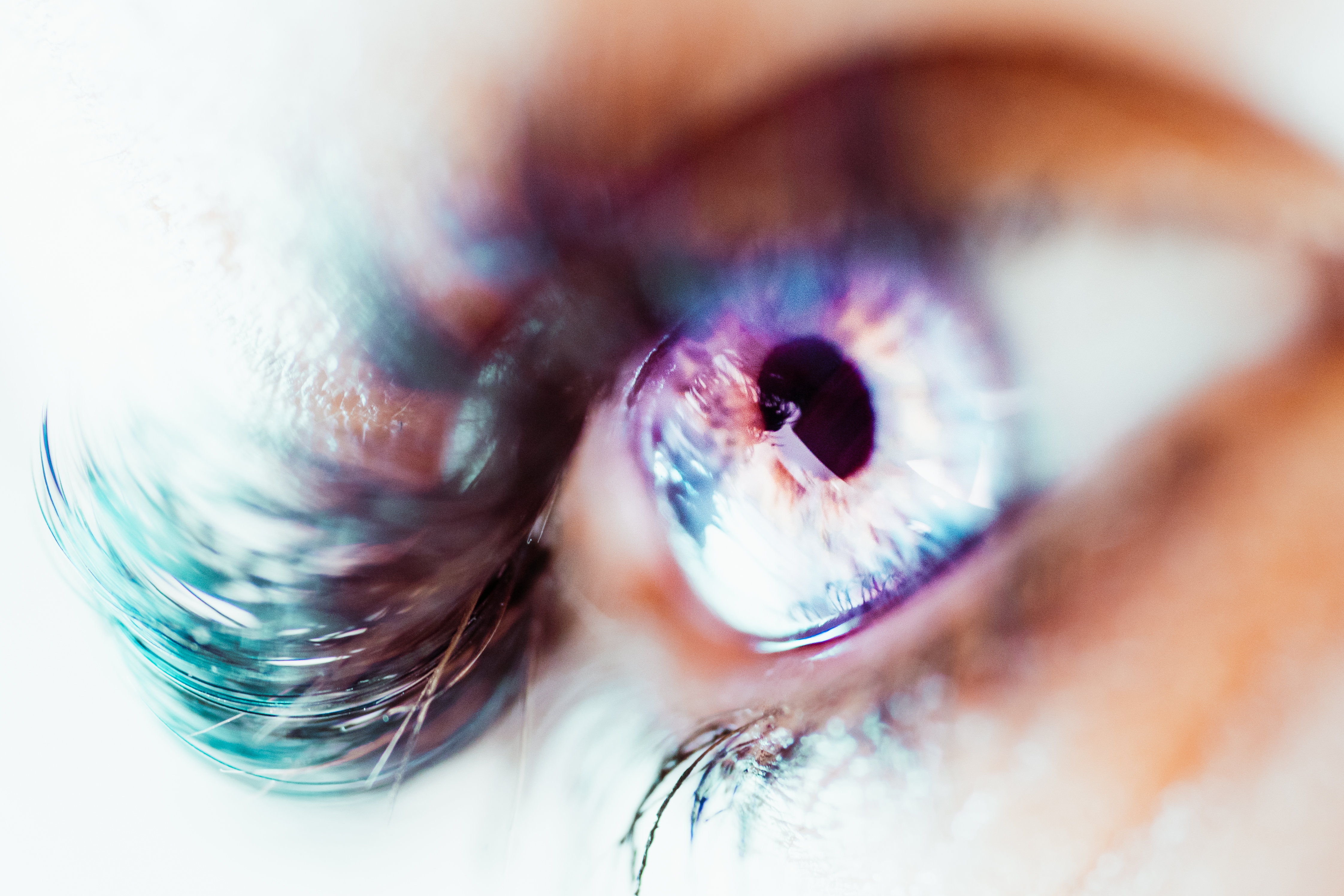 Dry Eye Syndrome Market Size Worth US$ 5.1 Billion by 2024 | CAGR 6.5% - IMARC Group Dry Eye Syndrome Market Size Worth US$ 5.1 Billion by 2024 | CAGR 6.5% - IMARC Group