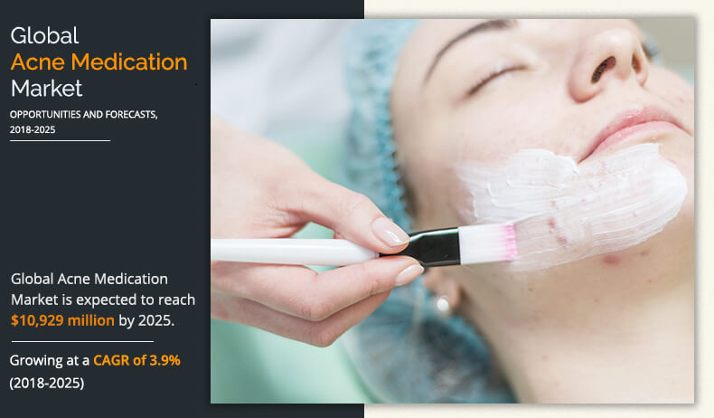 Acne Medication Market: Research Methodology Focuses on Exploring Major Factors Influencing the Industry Development  at a CAGR of 3.9% from 2018 to 2025.