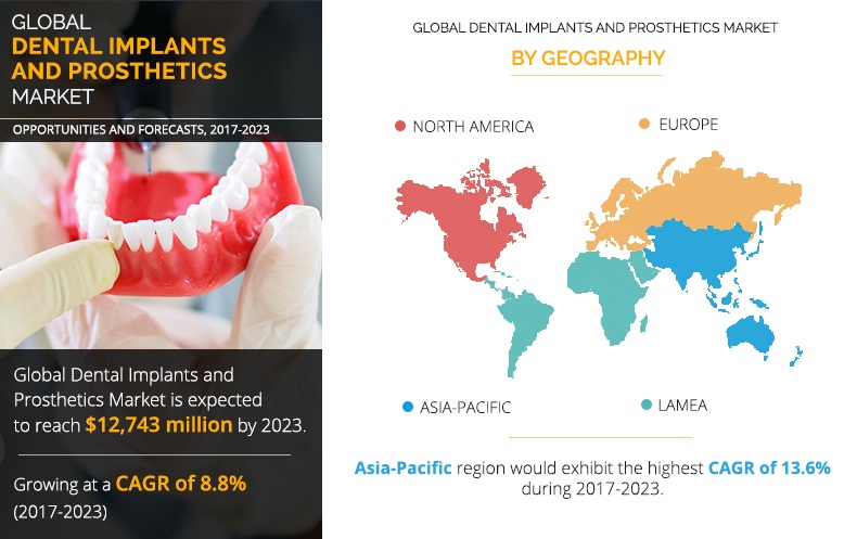 Dental Implants and Prosthetics Market Expected to Reach $12,743 Million, Globally, by 2023
