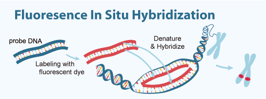 Global Fluorescent In Situ Hybridization (FISH) Probe Market Business Planning Research and Resources, Supply and Revenue 2018-2026 Global Fluorescent In Situ Hybridization (FISH) Probe Market Business Planning Research and Resources, Supply and Revenue 2018-2026