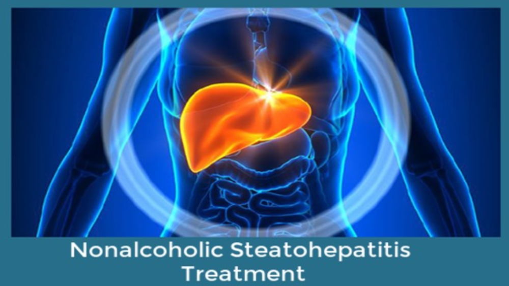 Nonalcoholic Steatohepatitis Treatment Market is expected to Foresee Tremendous Growth by 2026 | Insights by Drug, Distribution and Regional Forecast 2026