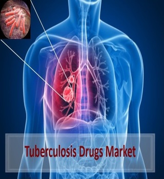 Tuberculosis Drugs Market Surges past US$ 2 Billion by 2024 | Coherent Market Insights