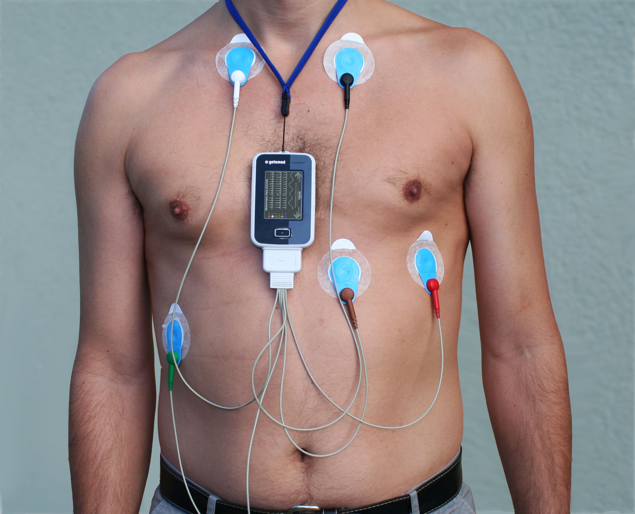 Cardiac Holter Monitor Market Report, Global Industry Overview, Growth and Forecast 2019-2024