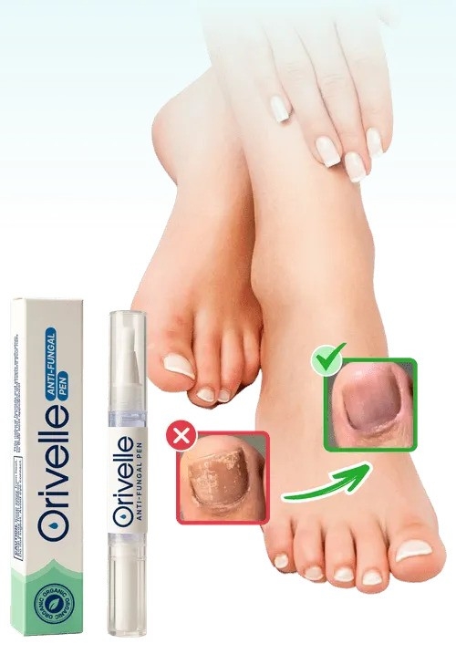 Orivelle Review (2025) Does This Natural Nail Anti-Fungal Pen Actually Work? Orivelle Review (2025) Does This Natural Nail Anti-Fungal Pen Actually Work?
