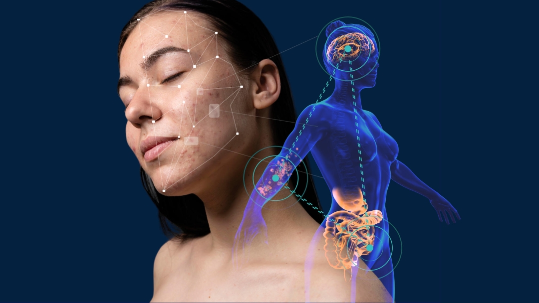 Codex Labs to Attend Health.tech Global Summit to Advance Root Cause Dermatology Innovation