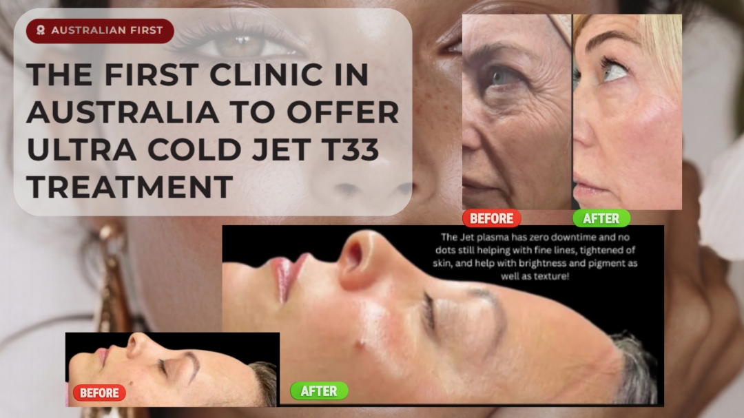 Fibro Plasma Perth becomes first Australian provider of Ultra Cold Jet T33 plasma technology Fibro Plasma Perth becomes first Australian provider of Ultra Cold Jet T33 plasma technology