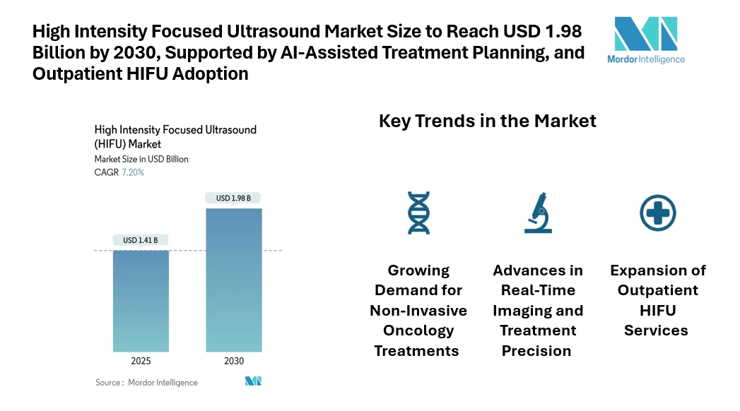 High Intensity Focused Ultrasound Market Size to Reach USD 1.98 Billion by 2030, Supported by Non-Invasive Oncology, AI-Assisted Treatment Planning, and Outpatient HIFU Adoption High Intensity Focused Ultrasound Market Size to Reach USD 1.98 Billion by 2030, Supported by Non-Invasive Oncology, AI-Assisted Treatment Planning, and Outpatient HIFU Adoption