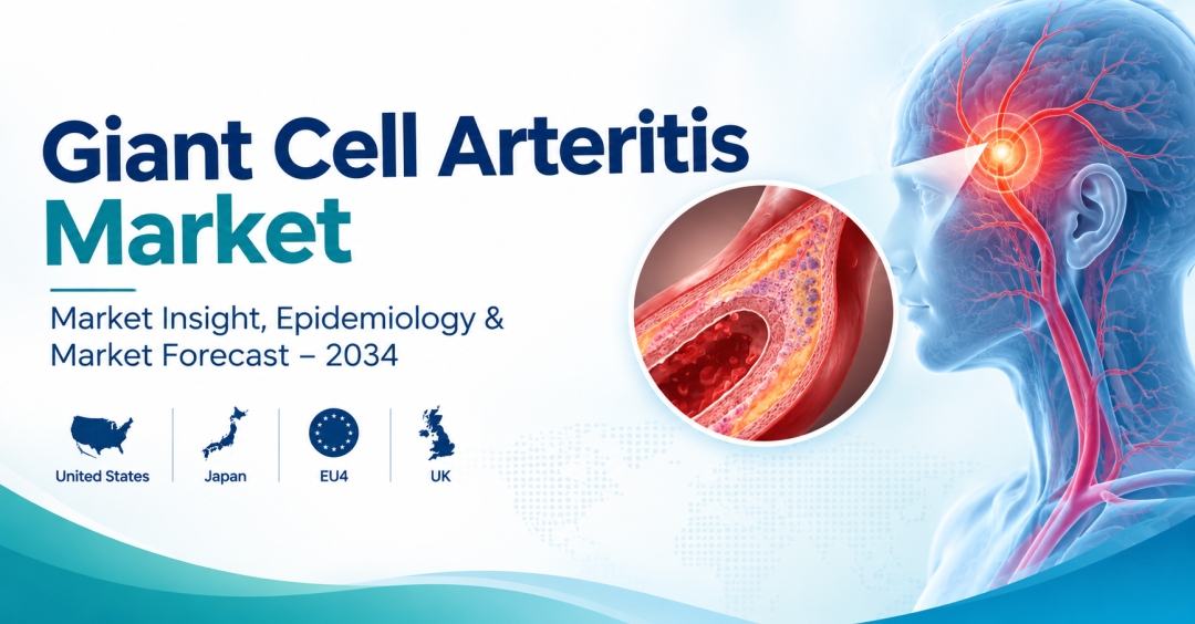 Giant Cell Arteritis Market Set for Significant Growth Through 2034 Driven by Advancing Therapies, Rising Diagnosed Cases, and Expanding Treatment Landscape | DelveInsight Giant Cell Arteritis Market Set for Significant Growth Through 2034 Driven by Advancing Therapies, Rising Diagnosed Cases, and Expanding Treatment Landscape | DelveInsight