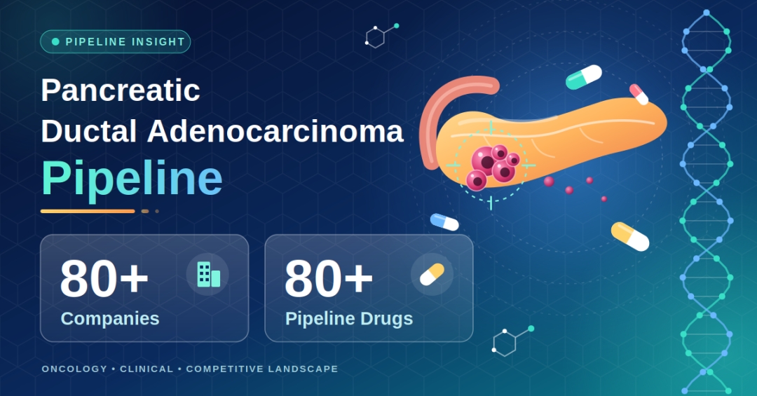 Pancreatic Ductal Adenocarcinoma Clinical Trial Pipeline Appears Robust With 80+ Key Pharma Companies Actively Working in the Therapeutics Segment | DelveInsight Pancreatic Ductal Adenocarcinoma Clinical Trial Pipeline Appears Robust With 80+ Key Pharma Companies Actively Working in the Therapeutics Segment | DelveInsight