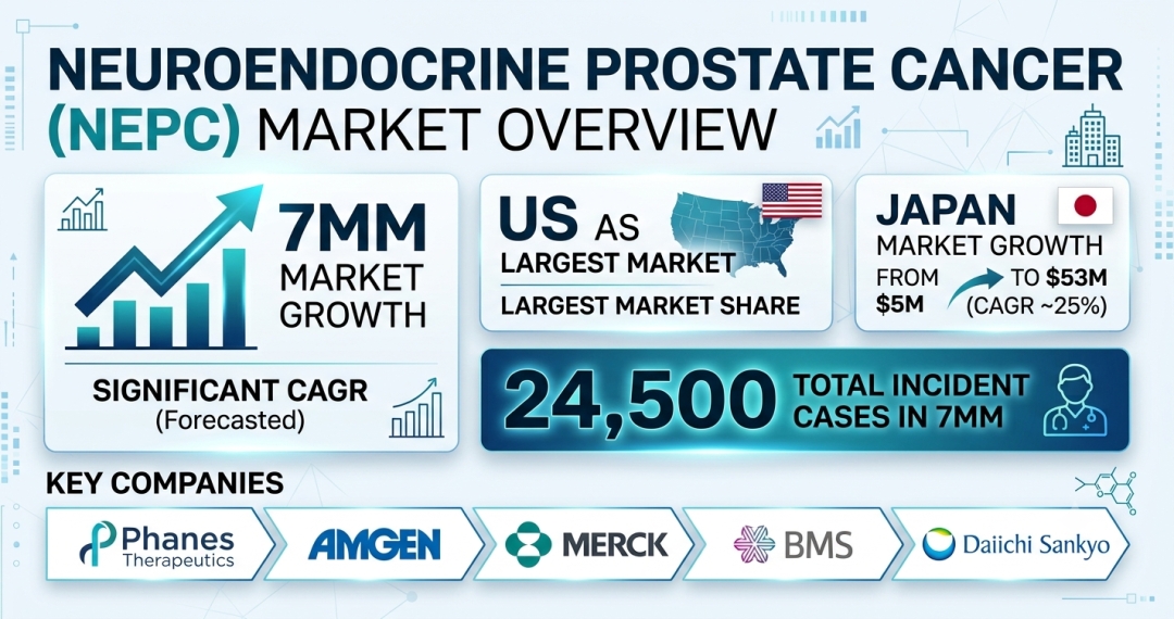 Neuroendocrine Prostate Cancer Market Size in the 7MM is projected to grow at a significant CAGR over the forecast period of 2026-2036 | DelveInsight Neuroendocrine Prostate Cancer Market Size in the 7MM is projected to grow at a significant CAGR over the forecast period of 2026-2036 | DelveInsight