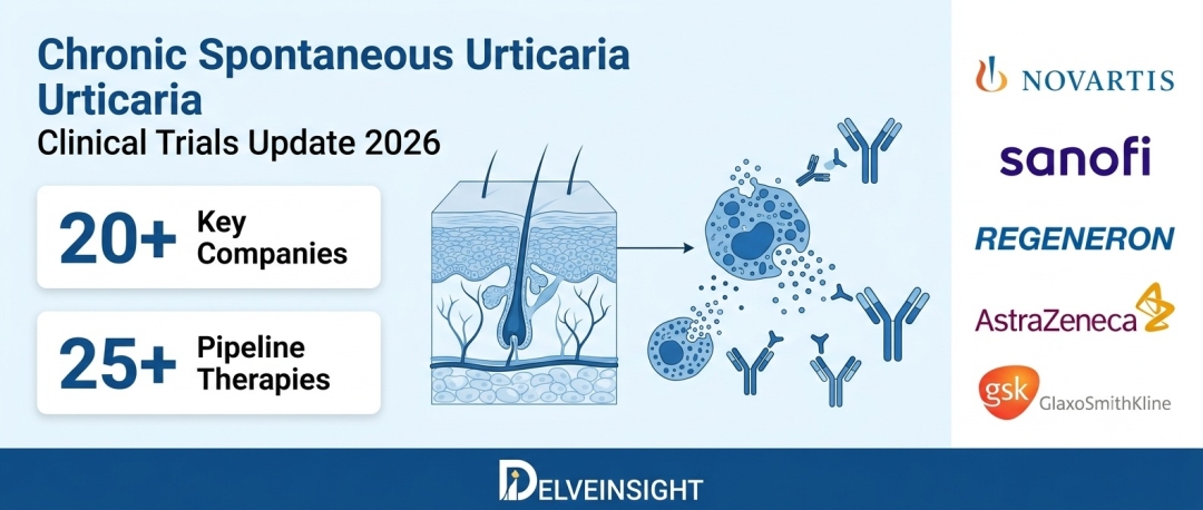Chronic Spontaneous Urticaria Clinical Trials Update 2026: Phase-Wise Pipeline Status, Drug Profiles, and Key Developers | Allakos, AstraZeneca, Biosana, Celldex Therapeutics, Celltrion, Eli Lilly Chronic Spontaneous Urticaria Clinical Trials Update 2026: Phase-Wise Pipeline Status, Drug Profiles, and Key Developers | Allakos, AstraZeneca, Biosana, Celldex Therapeutics, Celltrion, Eli Lilly
