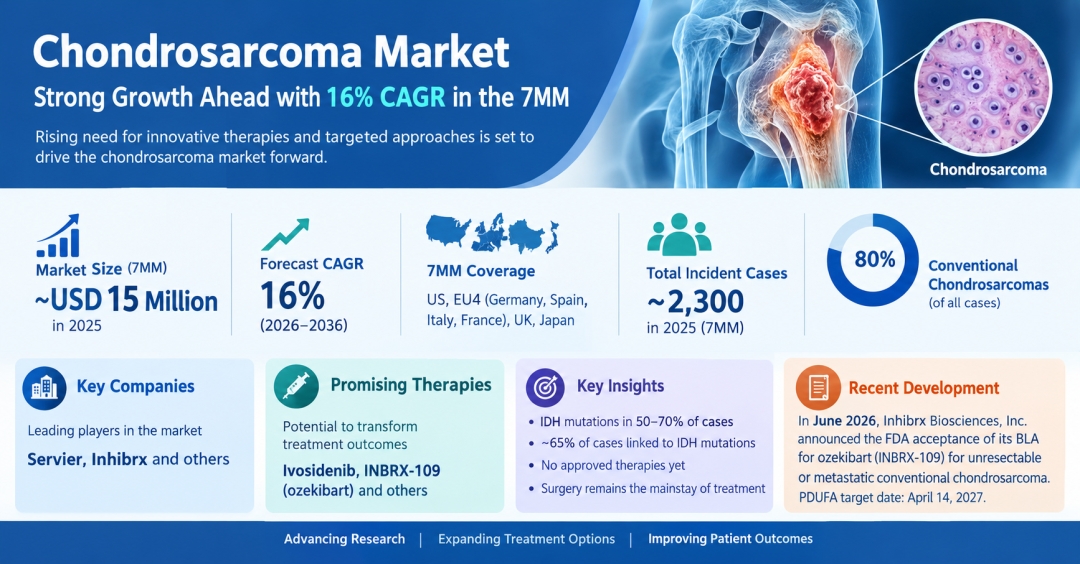 Chondrosarcoma Market Size in the 7MM is projected to grow at a 16% CAGR over the forecast period of 2026-2036 | DelveInsight Chondrosarcoma Market Size in the 7MM is projected to grow at a 16% CAGR over the forecast period of 2026-2036 | DelveInsight
