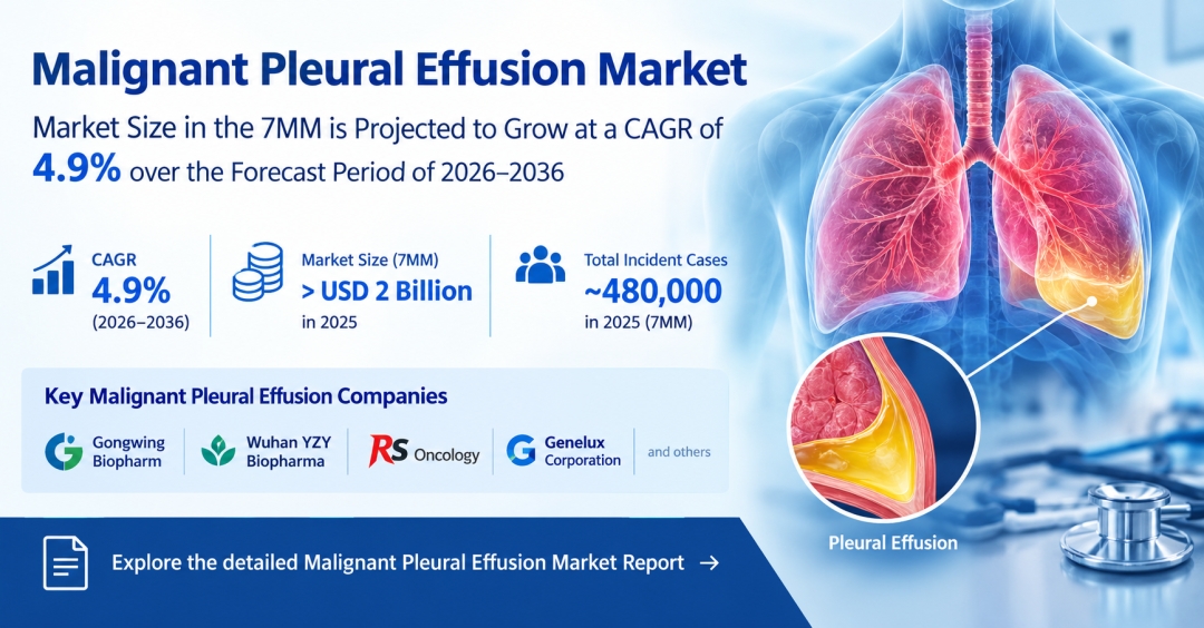 Malignant Pleural Effusion Market Size in the 7MM is projected to grow at a CAGR of 4.9% over the forecast period of 2026-2036 | DelveInsight Malignant Pleural Effusion Market Size in the 7MM is projected to grow at a CAGR of 4.9% over the forecast period of 2026-2036 | DelveInsight