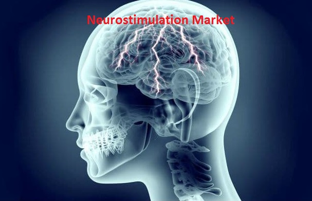 Global Neurostimulation Market Overview Analysis, Trends And Forecast to 2019-2024 Key Players Medtronic, Abbott, Boston Scientific Corporation, LivaNova PLC, Cochlear Ltd., MED-EL, Nevro Corp., Neuro Global Neurostimulation Market Overview Analysis, Trends And Forecast to 2019-2024 Key Players Medtronic, Abbott, Boston Scientific Corporation, LivaNova PLC, Cochlear Ltd., MED-EL, Nevro Corp., Neuro