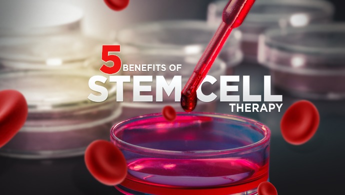 New Research and Development In-depth Study on Stem Cell Therapy Market