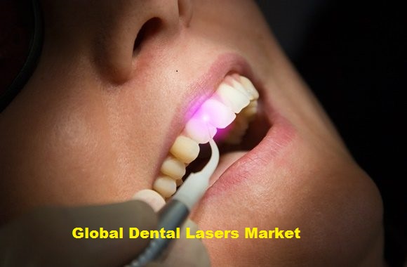 Dental Lasers Market 2019 Global Industry Major Key Players like THE YOSHIDA DENTAL MFG. CO.,LTD., Zolar Technology & Mfg Co. Inc., FONA Dental, s.r.o., Convergent Dental, GPT Dental, Inc., etc. Dental Lasers Market 2019 Global Industry Major Key Players like THE YOSHIDA DENTAL MFG. CO.,LTD., Zolar Technology & Mfg Co. Inc., FONA Dental, s.r.o., Convergent Dental, GPT Dental, Inc., etc.