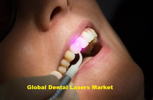 Dental Lasers Market  2019 Global Industry Major Key Players like THE YOSHIDA DENTAL MFG. CO.,LTD., Zolar Technology & Mfg Co. Inc., FONA Dental, s.r.o., Convergent Dental, GPT Dental, Inc., etc.