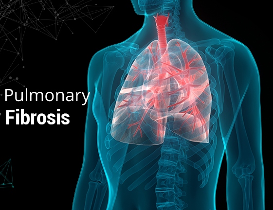 Idiopathic Pulmonary Fibrosis Treatment Market Global Size Expected to Register a Growth of CAGR of 12.3% Till 2025 – Latest Professional and Clinical Assessment Report 2019