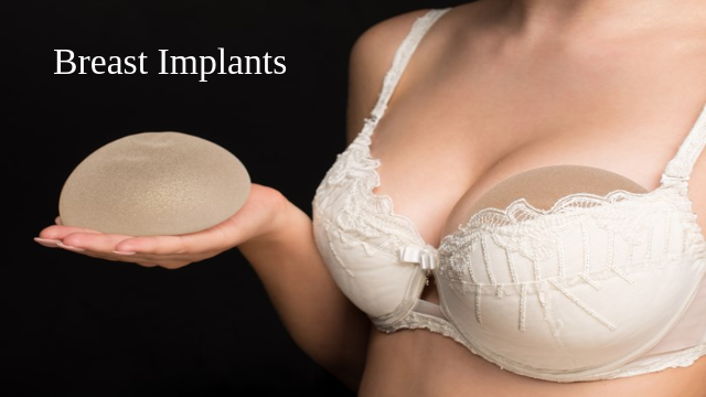 Asian Breast Implants Market to Surpass US $ 257.48 Million by 2026 | Growing Popularity and Emerging Trends