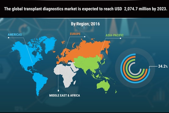 Transplant diagnostics Market Size, Value Share 2019 | Brand Analysis, Growth Factors, Business Statistics, Development Trends and Key Players Strategy by Forecast to 2023