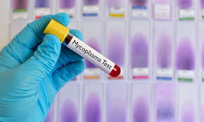 Mycoplasma Testing Market to See Massive Growth by 2025 | Thermo Fisher Scientific, Charles River Laboratories International, Lonza