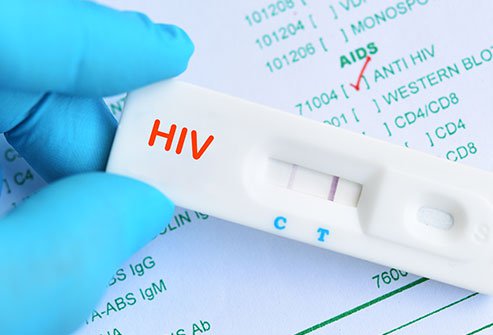 AIDS Rapid Test Kit Market Future Demand Analysis, Features Industry sizes, Key Objective Forcast upto 2020-2025