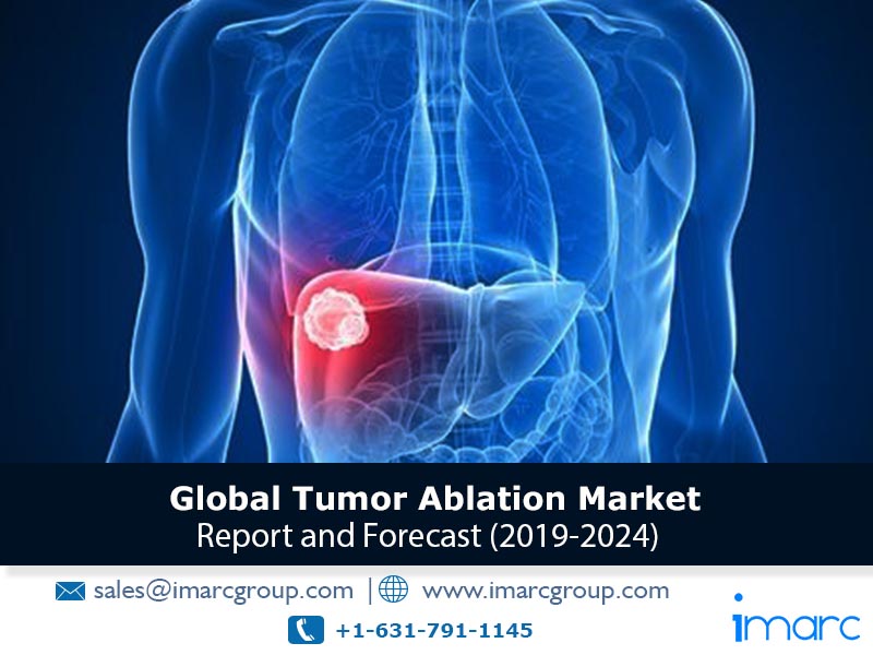 Tumor Ablation Market Growth Analysis, Top Companies, Industry Overview, Demand, Regional Analysis and Forecast 2024