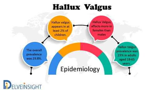 Hallux Valgus Epidemiology Forecast to 2030