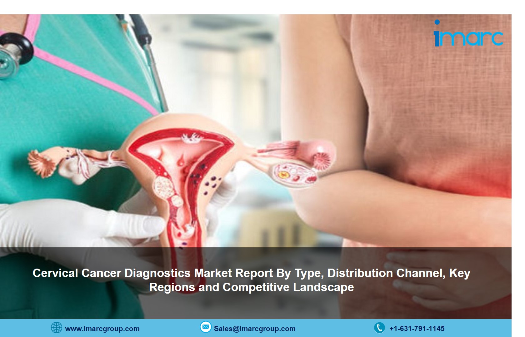 Cervical Cancer Diagnostics Market 2021-26: Size. Share, Trends by Healthcare Industry