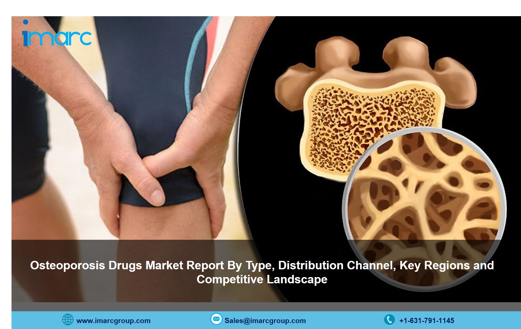 Osteoporosis Drugs Market 2021-26: Size. Share, Price and Industry Trends