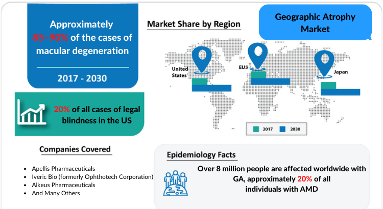 Geographic Atrophy Market Growth factors and Market Forecast 2030