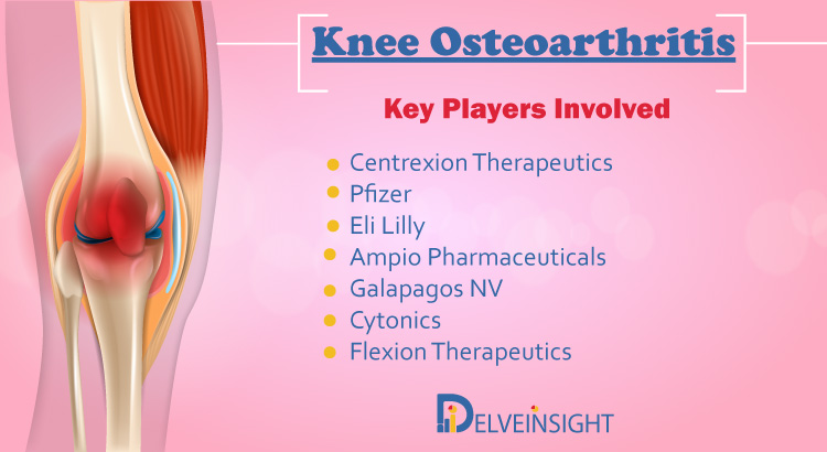 Knee Osteoarthritis Market Insight, Epidemiology, and Market Forecast Analysis Report