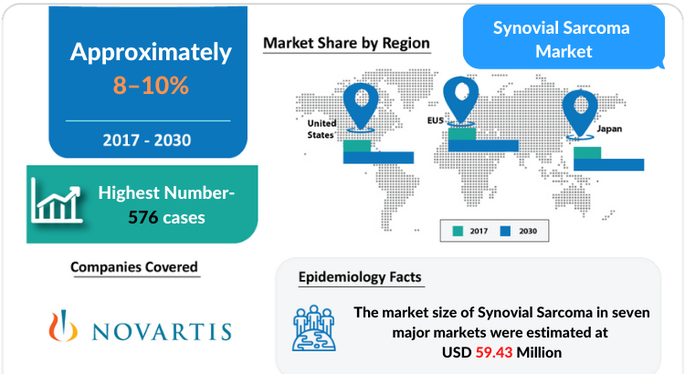 Synovial Sarcoma Market Insights, Share, Size, Growth and Market Forecast 2030