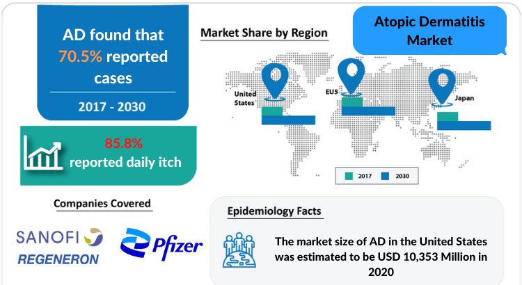 Atopic Dermatitis Market Professional Industry Research Report 2030