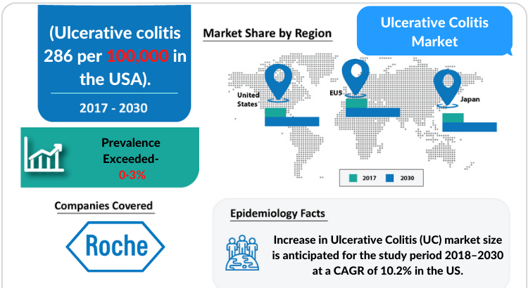 Ulcerative Colitis Market Professional Industry and Market Forecast by 2030