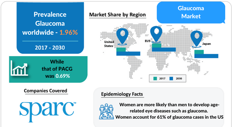 Glaucoma Market Professional and Market Forecast 2030 by DelveInsight