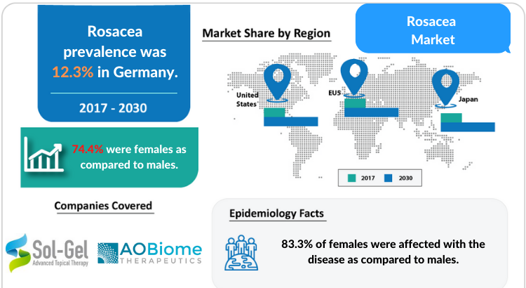 Rosacea Symptoms, Types, Treatment and Market Report by DelveInsight