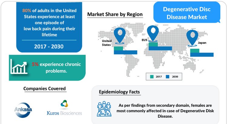 Degenerative Disc Disease Market Insights, Symptoms, Diagnosis and Market Report by DelveInsight