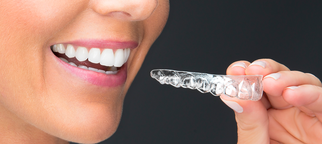 Clear Aligners Market 2021 Incredible Possibilities, Growth Analysis and Forecast To 2031