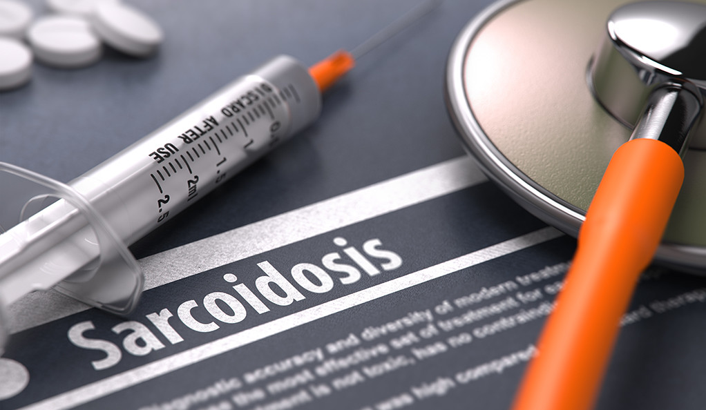 Sarcoidosis Drug Market to Witness Rise in Revenues During the Period 2021-2031
