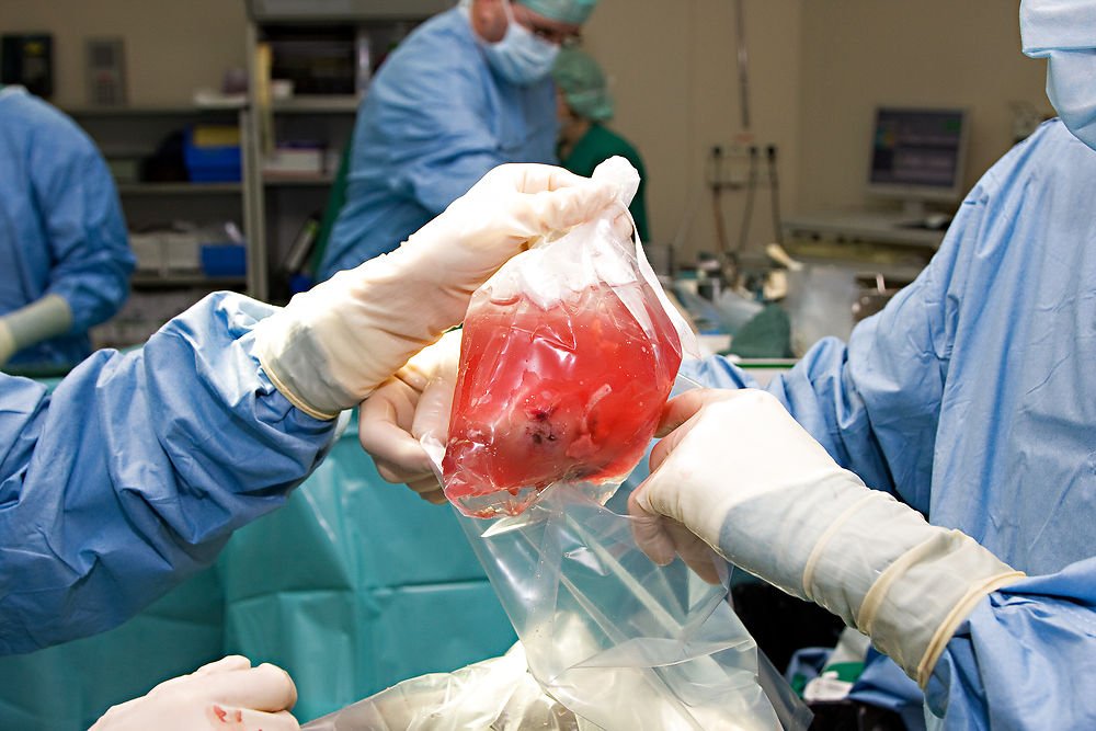 Organ Preservation Solutions Market to Grow at an Escalating Rate During the Forecast Period Till 2031