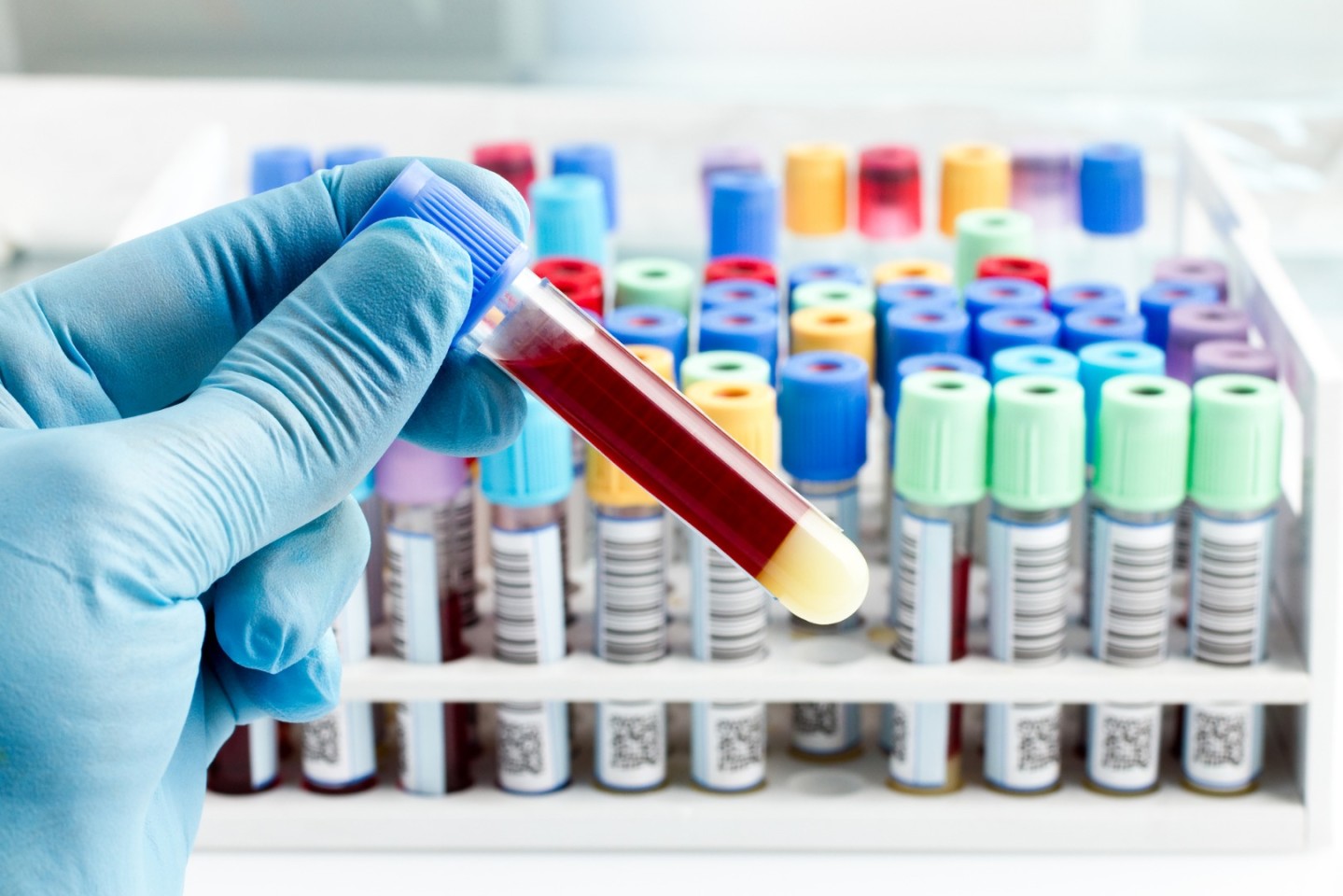 Blood Screening Market Rising Size, Huge Demand Growth Opportunities with COVID-19 Impact Analysis By 2031