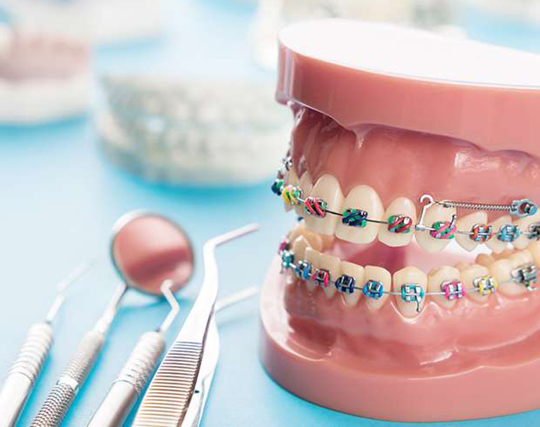 Orthodontics Market Immense Development Trends And High Potential Growth across The Globe By 2031