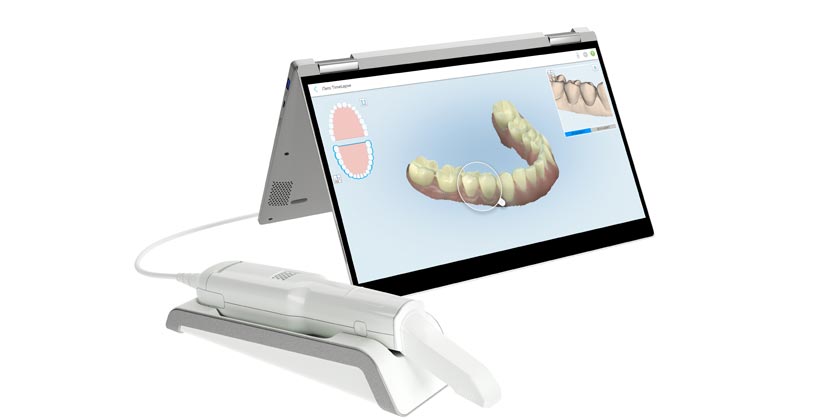 Digital Impression Standalone Scanners Market Poised to Surge USD 720 Million By 2031