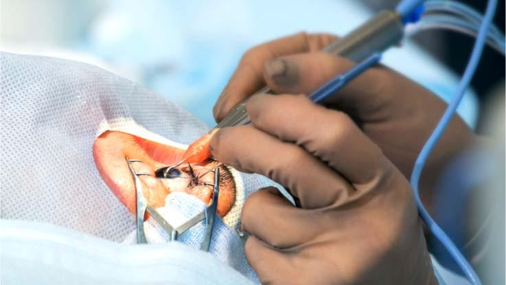 Surgical Lasers Market to Hold a High Potential for Growth by 2031, Says insightSLICE