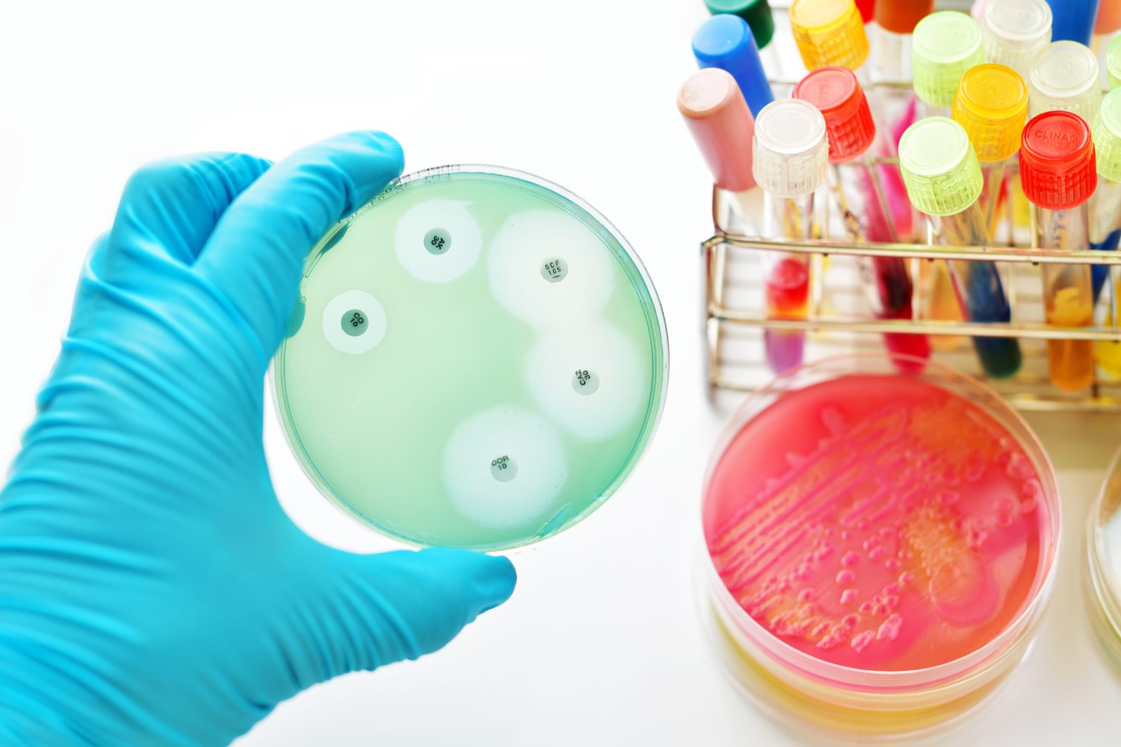 Antimicrobial Susceptibility Test Market to Receive Overwhelming Hike in Revenue That Will Boost Overall Industry Growth by 2031