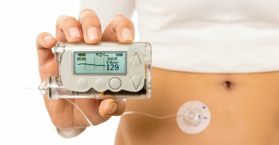 Insulin Pump Market Rising Size, Huge Business Growth Opportunities with COVID-19 Impact Analysis By 2031