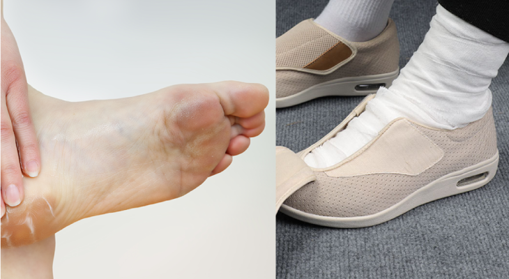 Easy Slippers Review: Does it Really Work? Consumer Report Released 