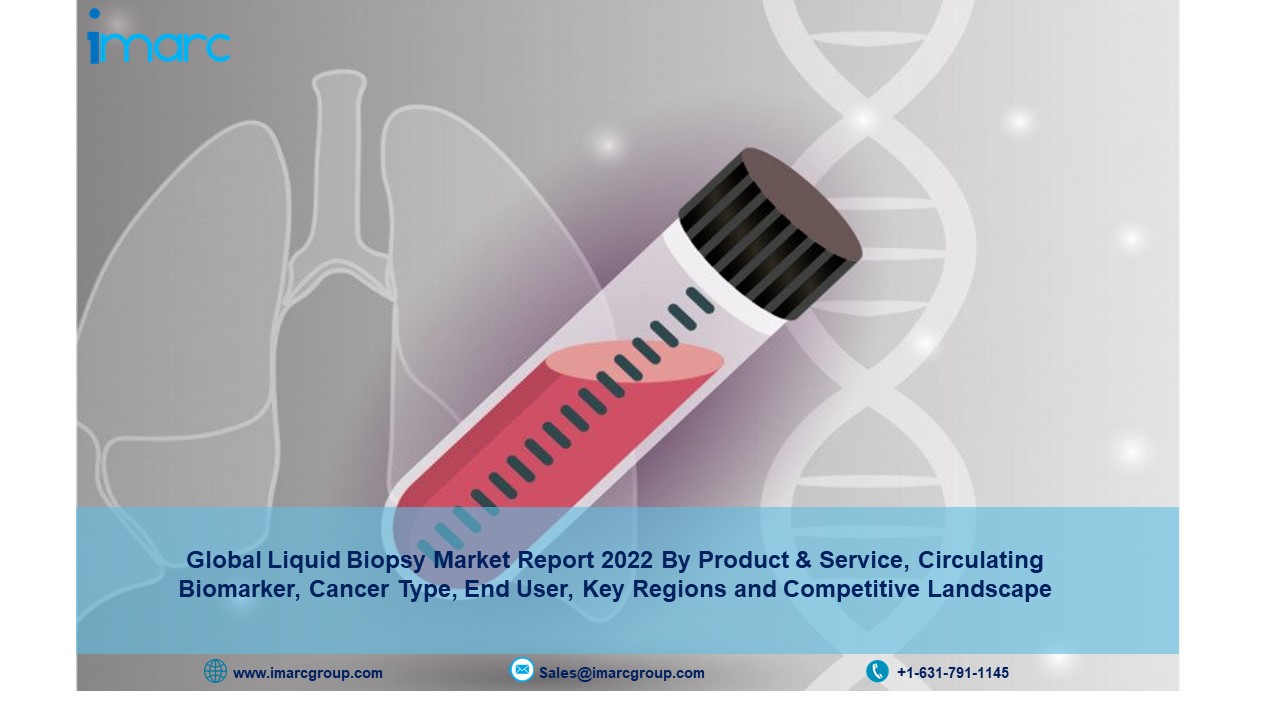 Liquid Biopsy Market Size, Share, Growth, Research, Analysis and Forecast to 2022-2027